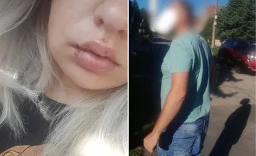 Muž v Galante brutálne napadol mamičku Mišku len preto, že ho neodzdravila. Dávajte si pozor na ľudí, apeluje na ženy