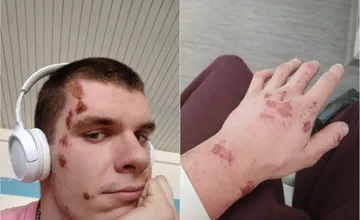 FOTO: Stano pátra po vodičovi, ktorý ho na bicykli pred Hlohovcom zrazil a z miesta ušiel, mal jediné šťastie...