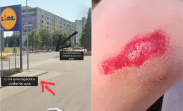 Trnavčanka hľadá svedkov incidentu, pri ktorom mal šofér napadnúť jej syna. Prechádzal cez priechod, keď v tom...