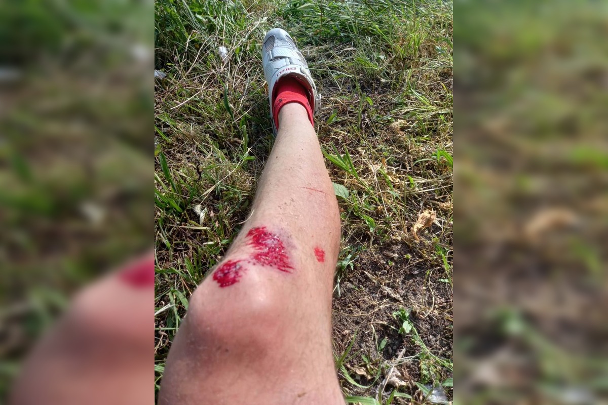 FOTO: Kolobežkár skončil po zrážke s cyklistom v nemocnici, foto 3