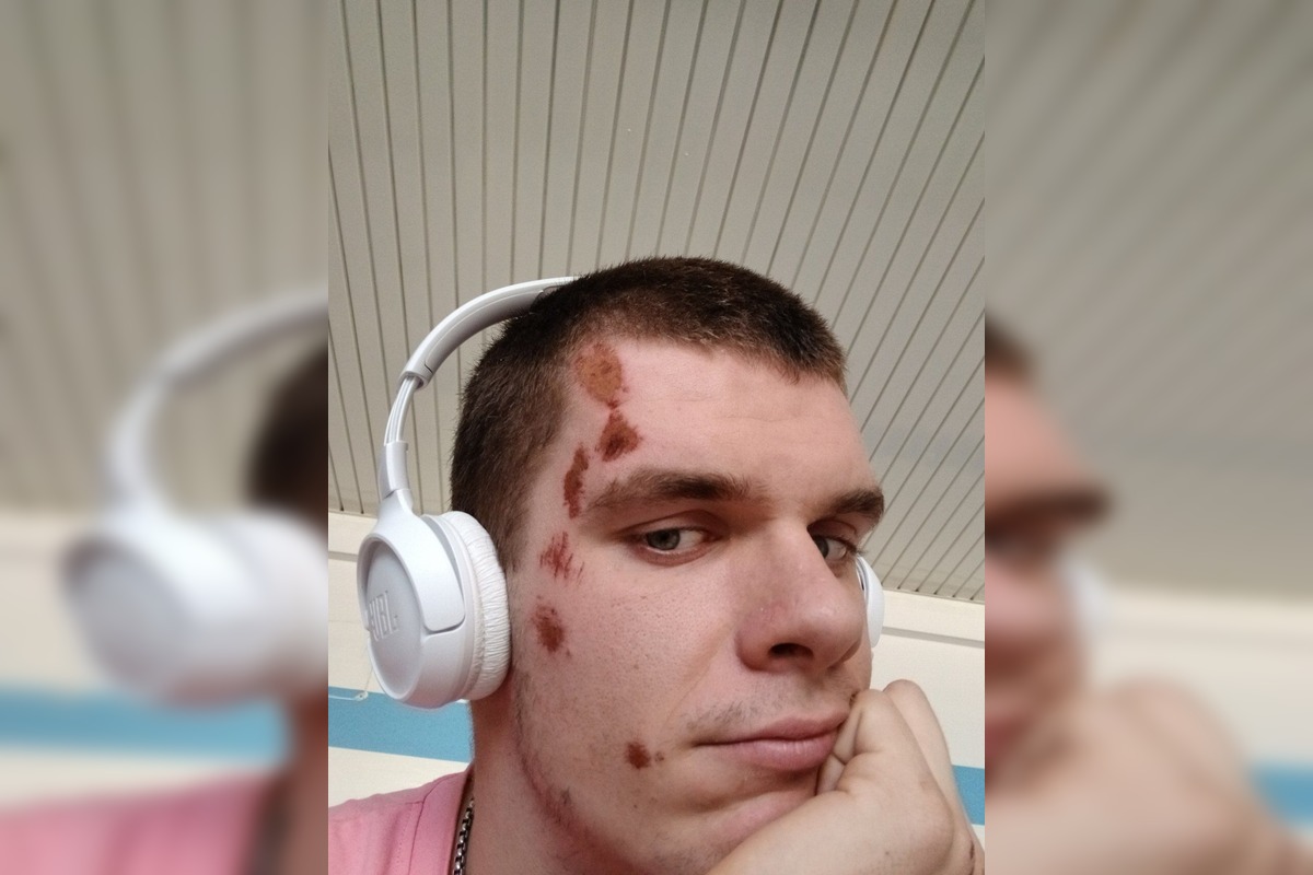 FOTO: Stana niekto zrazil cestou do Hlohovca, hľadá vinníka, foto 1