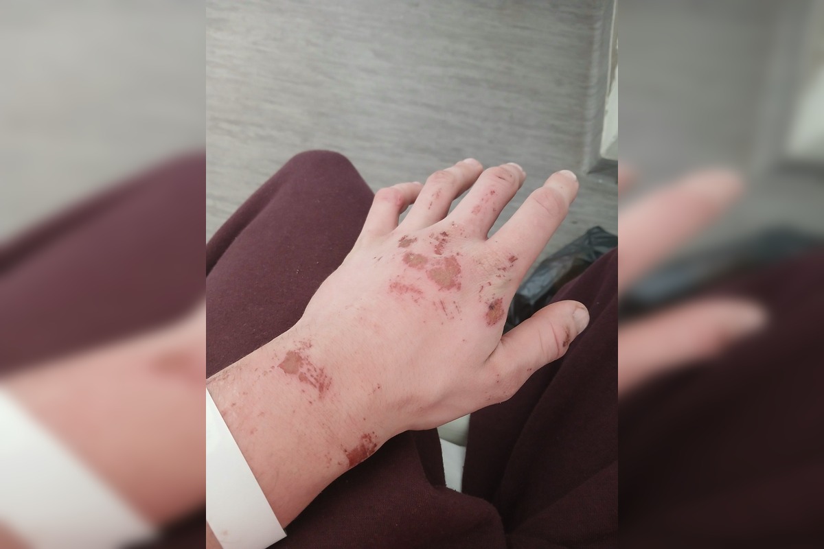 FOTO: Stana niekto zrazil cestou do Hlohovca, hľadá vinníka, foto 3