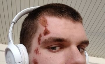 FOTO: Stana niekto zrazil cestou do Hlohovca, hľadá vinníka