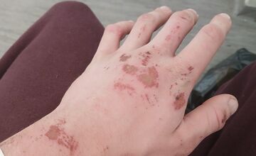 FOTO: Stana niekto zrazil cestou do Hlohovca, hľadá vinníka